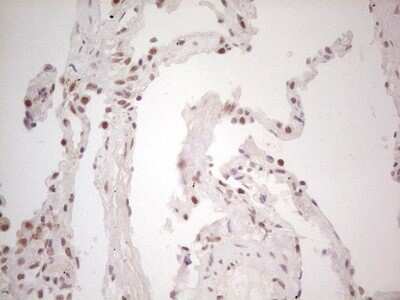 Immunohistochemistry: TRIB1 Antibody (OTI8C8) [NBP2-46205]