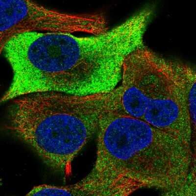 Immunocytochemistry/ Immunofluorescence: TRIB1 Antibody [NBP2-56559]