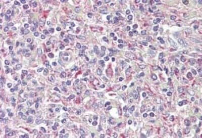 Immunohistochemistry-Paraffin: TRIB1 Antibody [NBP1-20988]