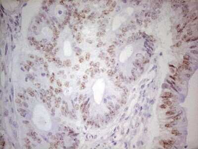 Immunohistochemistry: TRIB1 Antibody (OTI8C8) - Azide and BSA Free [NBP2-74596]