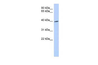 Western Blot: TRIB1 Antibody [NBP1-55386]