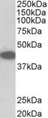 Western Blot: TRIB1 Antibody [NBP2-27557]