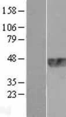 Western Blot: TRIB1 Overexpression Lysate [NBL1-17271]