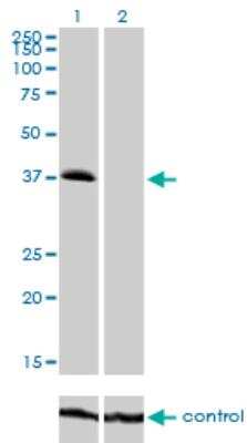 Western Blot: TRIB2 Antibody (1B1) [H00028951-M04]