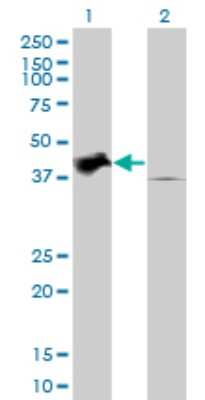 Western Blot: TRIB2 Antibody (1B1) [H00028951-M04]