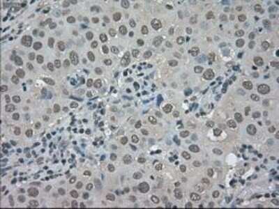 Immunohistochemistry: TRIB2 Antibody (OTI8D11) - Azide and BSA Free [NBP2-74597]