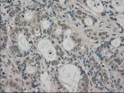 Immunohistochemistry: TRIB2 Antibody (OTI8D11) - Azide and BSA Free [NBP2-74597]