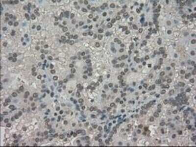 Immunohistochemistry: TRIB2 Antibody (OTI8D11) - Azide and BSA Free [NBP2-74597]