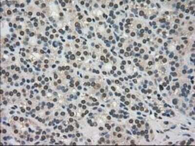 Immunohistochemistry: TRIB2 Antibody (OTI8D11) - Azide and BSA Free [NBP2-74597]