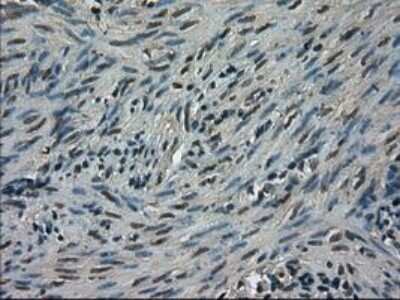 Immunohistochemistry: TRIB2 Antibody (OTI8D11) - Azide and BSA Free [NBP2-74597]