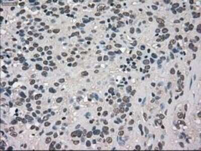 Immunohistochemistry: TRIB2 Antibody (OTI8D11) - Azide and BSA Free [NBP2-74597]