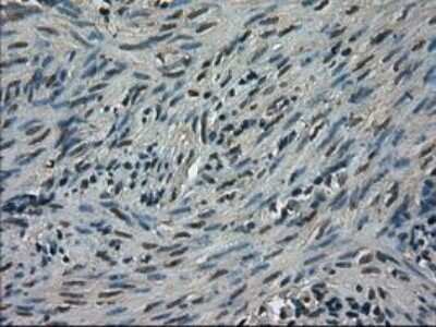 Immunohistochemistry-Paraffin: TRIB2 Antibody (OTI8D11) [NBP1-48030]
