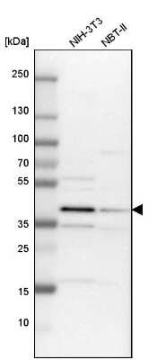 Western Blot: TRIB2 Antibody [NBP1-83326]