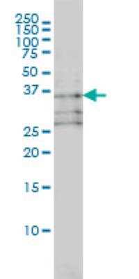 Western Blot: TRIB3 Antibody (1H2) [H00057761-M03]