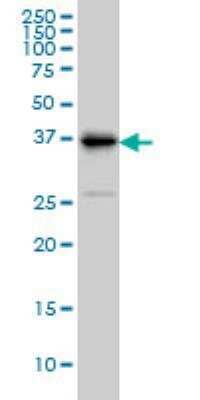 Western Blot: TRIB3 Antibody (2D1) [H00057761-M08]