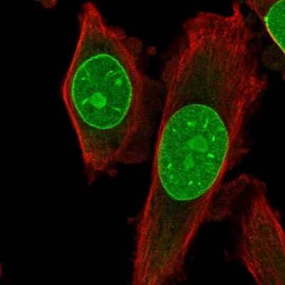 Immunocytochemistry/ Immunofluorescence: TRIB3 Antibody [NBP2-56109]