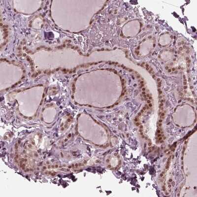 Immunohistochemistry-Paraffin: TRIB3 Antibody [NBP2-56109]