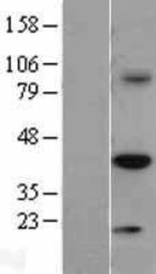 Western Blot: TRIB3 Overexpression Lysate [NBL1-17273]