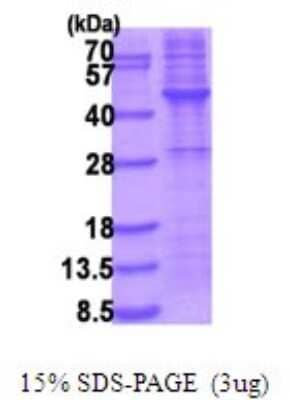 SDS-PAGE: Recombinant Human TRIB3 His Protein [NBP2-51929]