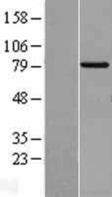 Western Blot: TRIF/TICAM1 Overexpression Lysate [NBL1-16907]