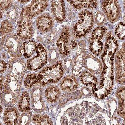 Immunohistochemistry-Paraffin: TRIF/TICAM1 Antibody [NBP1-89566]