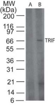 Western Blot: TRIF/TICAM1 AntibodyBSA Free [NB120-13810]