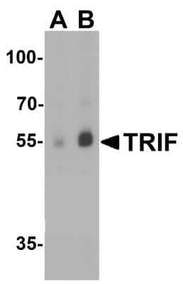 Western Blot: TRIF/TICAM1 AntibodyBSA Free [NBP2-31189]