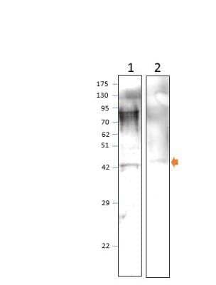 Western Blot: TRIF/TICAM1 Antibody [NBP3-12427]