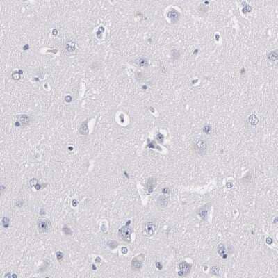 Immunohistochemistry-Paraffin: TRIM Antibody [NBP1-89660]