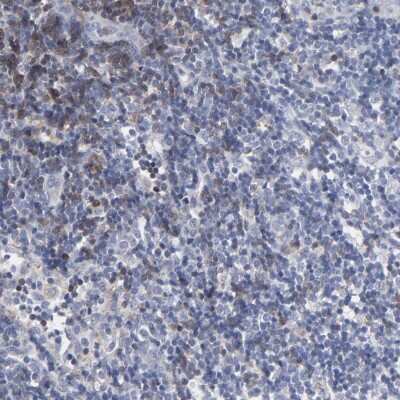 Immunohistochemistry-Paraffin: TRIM Antibody [NBP1-89660]