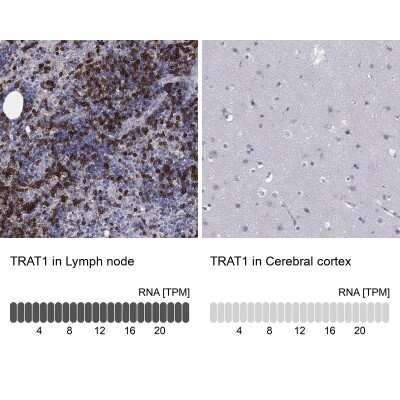 Immunohistochemistry-Paraffin: TRIM Antibody [NBP3-17096]