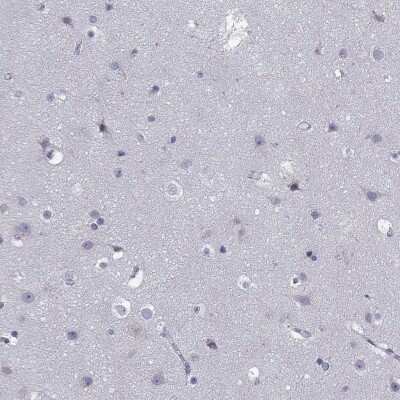 Immunohistochemistry-Paraffin: TRIM Antibody [NBP3-17096]