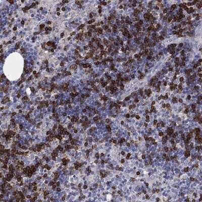 Immunohistochemistry-Paraffin: TRIM Antibody [NBP3-17096]