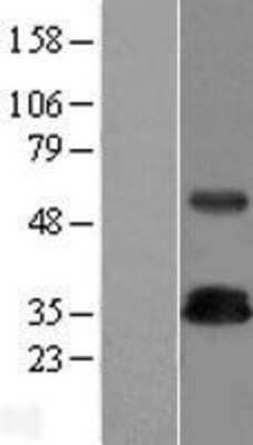 Western Blot: TRIM Overexpression Lysate [NBP2-07044]