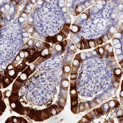 Immunohistochemistry-Paraffin: TRIM10 Antibody [NBP2-13479]