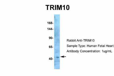 Western Blot: TRIM10 Antibody [NBP2-85982]