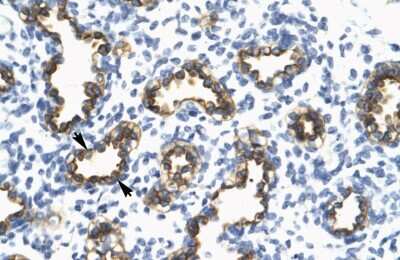 Immunohistochemistry: TRIM13 Antibody [NBP2-88466]