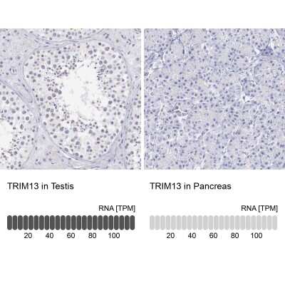 Immunohistochemistry-Paraffin: TRIM13 Antibody [NBP1-85016]