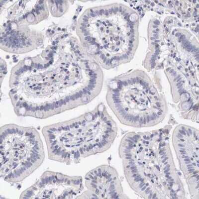 Immunohistochemistry-Paraffin: TRIM13 Antibody [NBP1-85016]