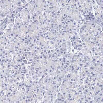 Immunohistochemistry-Paraffin: TRIM13 Antibody [NBP1-85016]