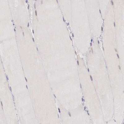 Immunohistochemistry-Paraffin: TRIM13 Antibody [NBP1-85016]