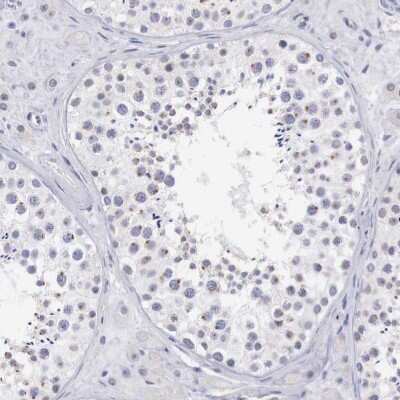 Immunohistochemistry-Paraffin: TRIM13 Antibody [NBP1-85016]