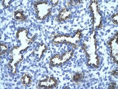 Immunohistochemistry-Paraffin: TRIM13 Antibody [NBP2-88466]