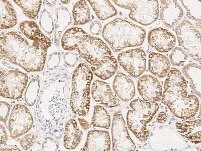 Immunohistochemistry-Paraffin: TRIM13 Antibody [NBP2-99022]