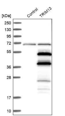 Western Blot: TRIM13 Antibody [NBP1-85016]
