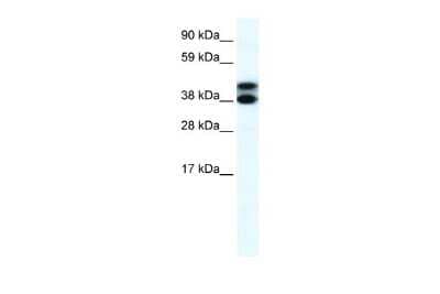 Western Blot: TRIM13 Antibody [NBP2-88466]