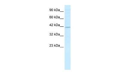 Western Blot: TRIM13 Antibody [NBP2-88467]