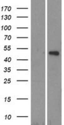 Western Blot: TRIM14 Overexpression Lysate [NBP2-05904]