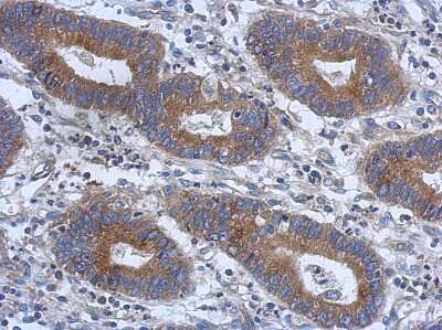 Immunohistochemistry-Paraffin: TRIM15 Antibody [NBP2-20706]