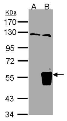 Western Blot: TRIM15 Antibody [NBP2-20707]